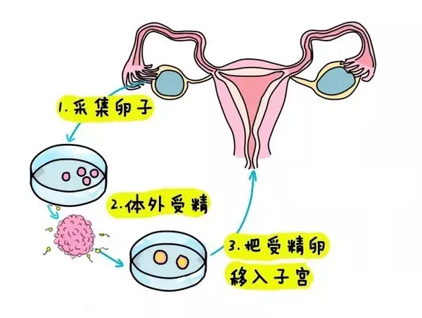 中国人保助孕宝试管保险