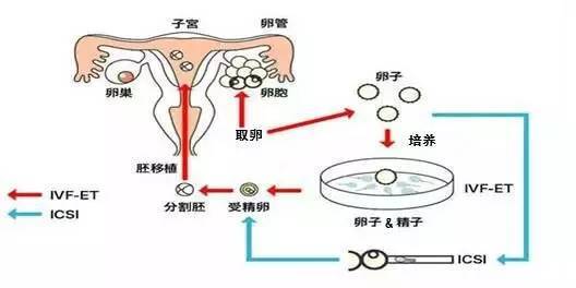 苏州做试管的医院